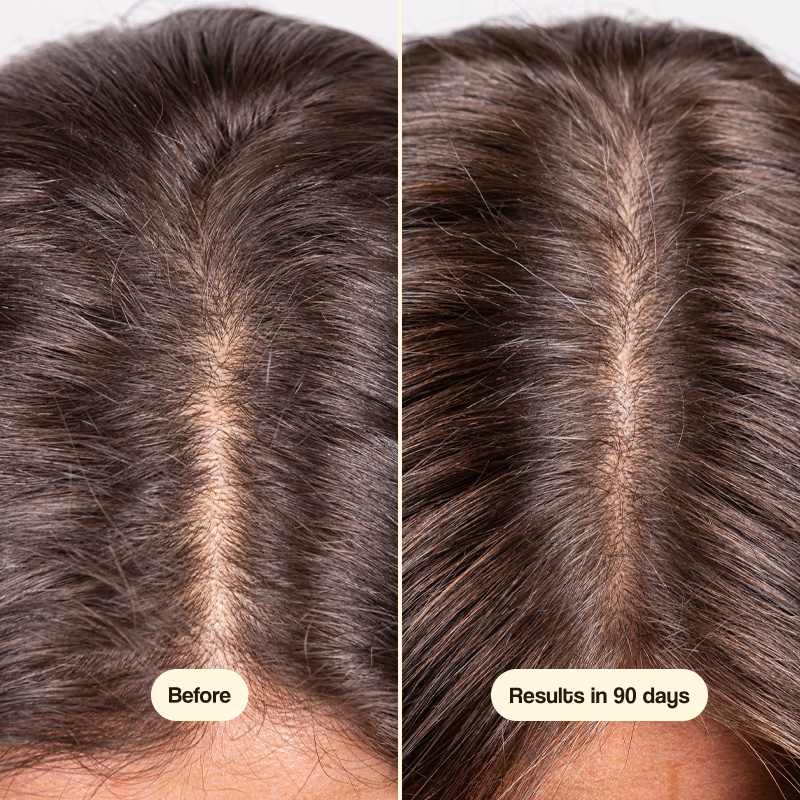 Clara's Regrowth Formula
